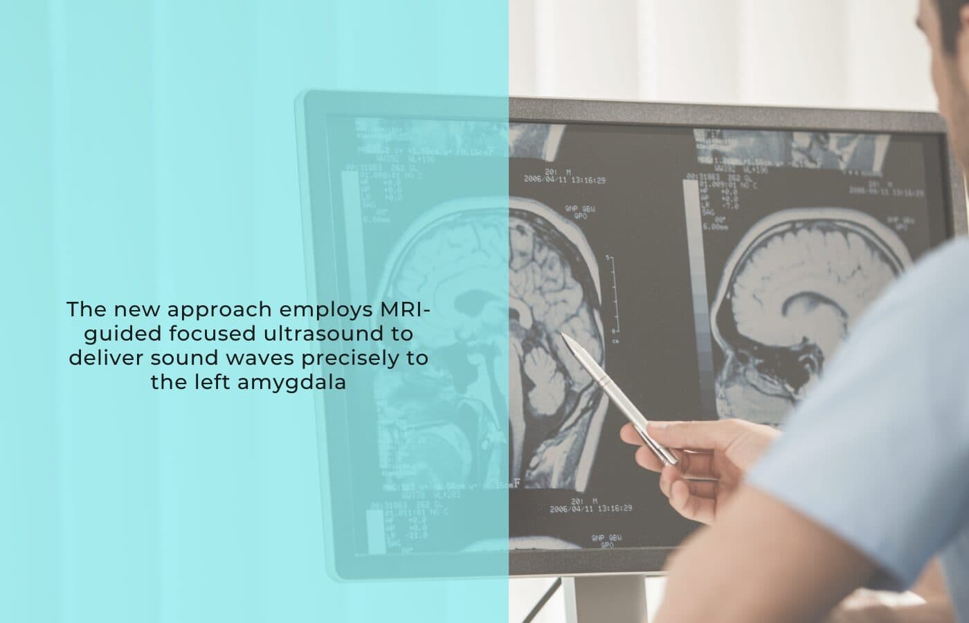 Breakthrough non-invasive brain stimulation offers new hope for depression, anxiety, and PTSD
